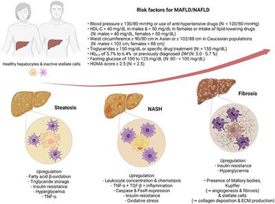 MAFLD/NAFLD Biopsy-Free Scoring Systems for Hepatic Steatosis, NASH, and Fibrosis Diagnosis